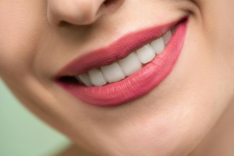 sorriso-denti-estetica
